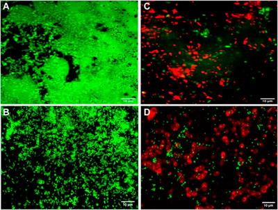 Synergistic and antibiofilm potential of Curcuma aromatica derived silver nanoparticles in combination with antibiotics against multidrug-resistant pathogens